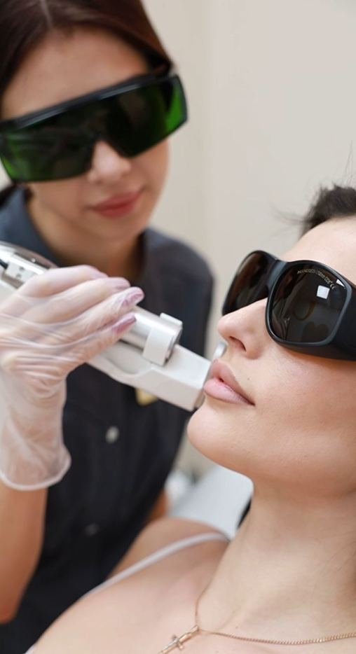 Лазерная эпиляция между бровей